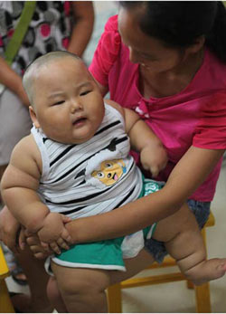 چاق‌ترین کودک جهان در چین